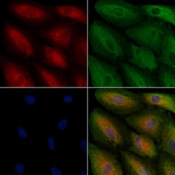 Invitrogen HSD17B11 Polyclonal Antibody 100 &mu;L; Unconjugated:Antibodies,