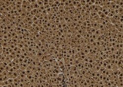 Invitrogen TPX2 Polyclonal Antibody 100 &mu;L; Unconjugated:Antibodies,