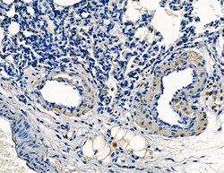 Invitrogen TPX2 Polyclonal Antibody 100 &mu;L; Unconjugated:Antibodies,