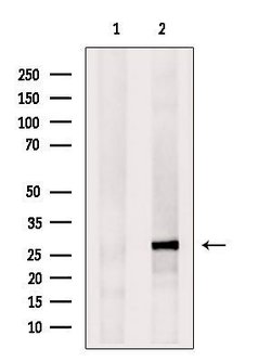 Invitrogen eIF4E3 Polyclonal Antibody 100 &mu;L; Unconjugated:Antibodies,