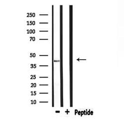 Invitrogen ELAVL2/ELAVL4 Polyclonal Antibody 100 &mu;L; Unconjugated:Antibodies,