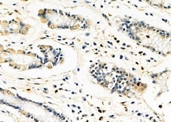 Invitrogen FASTKD2 Polyclonal Antibody 100 &mu;L; Unconjugated:Antibodies,