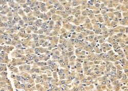 Invitrogen FASTKD2 Polyclonal Antibody 100 &mu;L; Unconjugated:Antibodies,