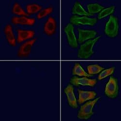 Invitrogen GAS6 Polyclonal Antibody 100 &mu;L; Unconjugated:Antibodies,