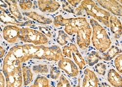 Invitrogen NOX1 Polyclonal Antibody 100 &mu;L; Unconjugated:Antibodies,