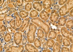 Invitrogen NOX1 Polyclonal Antibody 100 &mu;L; Unconjugated:Antibodies,