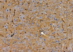 Invitrogen OR10K1/OR10K2 Polyclonal Antibody 100 &mu;L; Unconjugated:Antibodies,