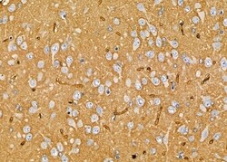 Invitrogen OR10K1/OR10K2 Polyclonal Antibody 100 &mu;L; Unconjugated:Antibodies,