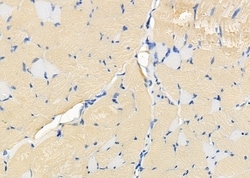 Invitrogen OR2T3/OR2T34 Polyclonal Antibody 100 &mu;L | Buy Online | Invitrogen&trade; | Fisher Scientific