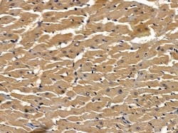 Invitrogen OR5H1 Polyclonal Antibody 100 &mu;L; Unconjugated:Antibodies,