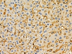 Invitrogen OR7C2 Polyclonal Antibody 100 &mu;L; Unconjugated:Antibodies,
