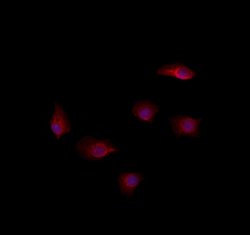 Invitrogen RAB35 Polyclonal Antibody 100 &mu;L; Unconjugated:Antibodies,