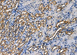 Invitrogen RAB35 Polyclonal Antibody 100 &mu;L; Unconjugated:Antibodies,