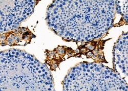 Invitrogen RAB35 Polyclonal Antibody 100 &mu;L; Unconjugated:Antibodies,