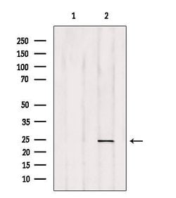 Invitrogen RAB35 Polyclonal Antibody 100 &mu;L; Unconjugated:Antibodies,