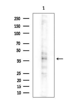 Invitrogen TNFRSF19L Polyclonal Antibody 100 &mu;L | Buy Online | Invitrogen&trade; | Fisher Scientific
