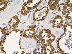 RGPD Pan Polyclonal Antibody:Antibodies, Polyclonal