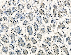 Invitrogen RHPN1 Polyclonal Antibody 100 &mu;L; Unconjugated:Antibodies,