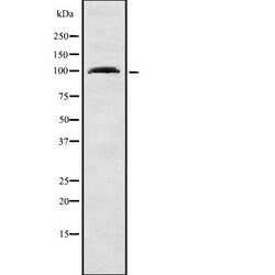 Invitrogen RHPN1 Polyclonal Antibody 100 &mu;L; Unconjugated:Antibodies,