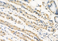 Invitrogen RIOK3 Polyclonal Antibody 100 &mu;L; Unconjugated:Antibodies,