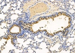 Invitrogen RIOK3 Polyclonal Antibody 100 &mu;L; Unconjugated:Antibodies,