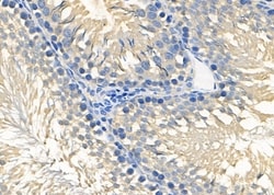 Invitrogen RIOK3 Polyclonal Antibody 100 &mu;L; Unconjugated:Antibodies,