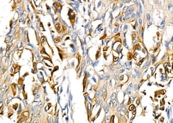 Invitrogen RNF19A Polyclonal Antibody 100 &mu;L | Buy Online | Invitrogen&trade; | Fisher Scientific