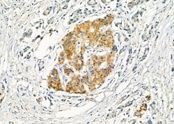 Invitrogen Slc30A8 Polyclonal Antibody 100 &mu;L; Unconjugated:Antibodies,