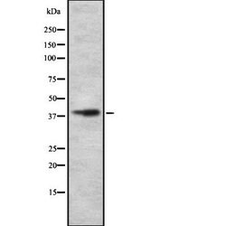 Invitrogen Slc30A8 Polyclonal Antibody 100 &mu;L; Unconjugated:Antibodies,
