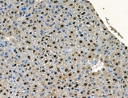 Invitrogen SP2 Polyclonal Antibody 100 &mu;L | Buy Online | Invitrogen&trade; | Fisher Scientific