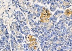 TAS2R43 Polyclonal Antibody:Antibodies, Polyclonal