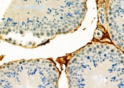 Invitrogen p53DINP1 Polyclonal Antibody 100 &mu;L; Unconjugated:Antibodies,