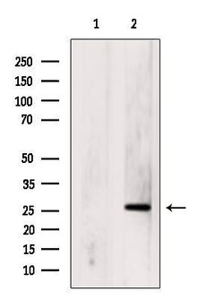 Invitrogen p53DINP1 Polyclonal Antibody 100 &mu;L; Unconjugated:Antibodies,