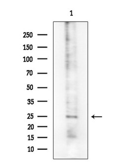 Invitrogen Phospho-CD28 (Tyr218) Polyclonal Antibody 100 &mu;L; Unconjugated:Antibodies,