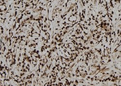 Invitrogen Phospho-Ephrin B1/B2/B3 (Tyr324) Polyclonal Antibody 100 &mu;L;