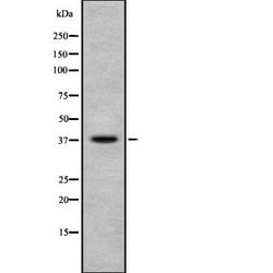 Invitrogen Phospho-Ephrin B1/B2/B3 (Tyr324) Polyclonal Antibody 100 &mu;L;