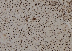 Invitrogen TGIF2LY Polyclonal Antibody 100 &mu;L | Buy Online | Invitrogen&trade; | Fisher Scientific