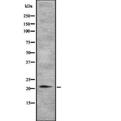 Invitrogen TGIF2LY Polyclonal Antibody 100 &mu;L | Buy Online | Invitrogen&trade; | Fisher Scientific
