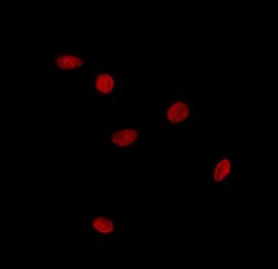 Invitrogen SOX12 Polyclonal Antibody 100 &mu;L; Unconjugated:Antibodies,