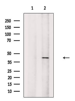 Invitrogen HOXA2 Polyclonal Antibody 100 &mu;L | Buy Online | Invitrogen&trade; | Fisher Scientific