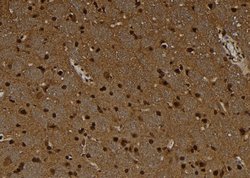 Invitrogen MAGEC1 Polyclonal Antibody 100 &mu;L; Unconjugated:Antibodies,