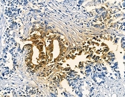Invitrogen MAGEC1 Polyclonal Antibody 100 &mu;L; Unconjugated:Antibodies,