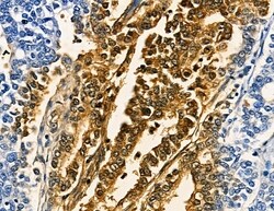 Invitrogen MAGEC1 Polyclonal Antibody 100 &mu;L; Unconjugated:Antibodies,