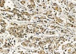 Invitrogen SAP30 Polyclonal Antibody 100 &mu;L; Unconjugated:Antibodies,