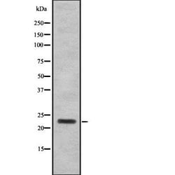 Invitrogen SAP30 Polyclonal Antibody 100 &mu;L; Unconjugated:Antibodies,