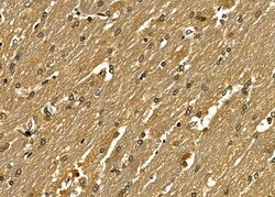 Invitrogen SNAPC5 Polyclonal Antibody 100 &mu;L; Unconjugated:Antibodies,