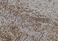 Invitrogen FSBP Polyclonal Antibody 100 &mu;L; Unconjugated:Antibodies,