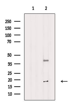 Invitrogen FSBP Polyclonal Antibody 100 &mu;L; Unconjugated:Antibodies,