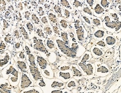 Invitrogen DUSP14 Polyclonal Antibody 100 &mu;L; Unconjugated:Antibodies,