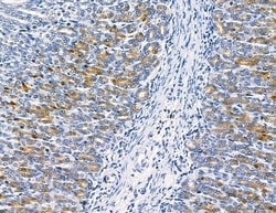 Invitrogen DUSP14 Polyclonal Antibody 100 &mu;L; Unconjugated:Antibodies,
